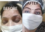 Suvarna Beauty Clinic & Spa